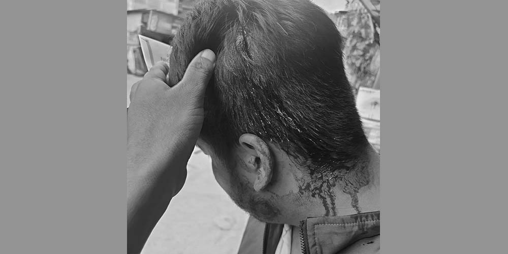 पर्वतमा एनआईसी एशिया बैंकका कर्मचारीमाथि कुटपिट